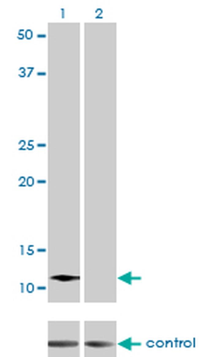 ACYP2 Antibody in Western Blot (WB)