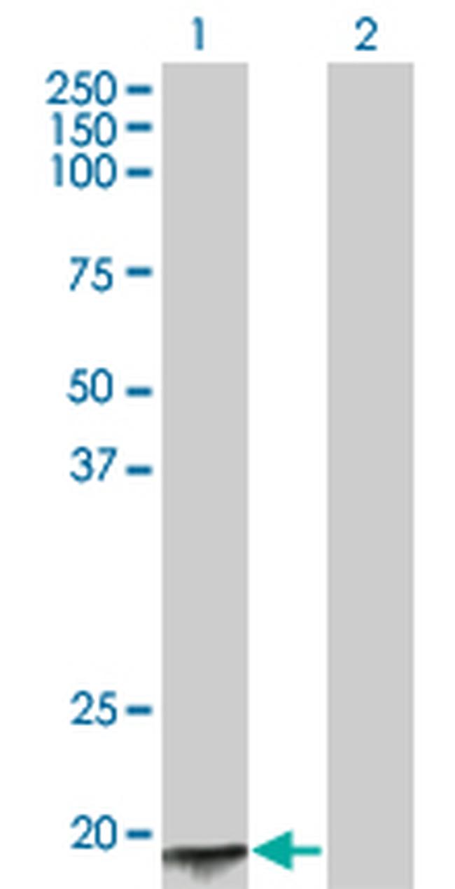 ACYP2 Antibody in Western Blot (WB)