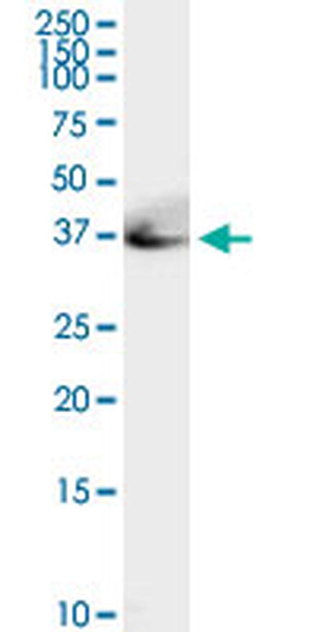 ADA Antibody in Western Blot (WB)