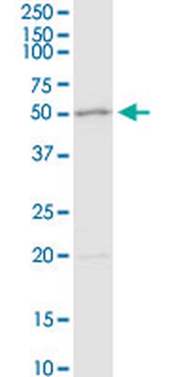 ADA Antibody in Western Blot (WB)