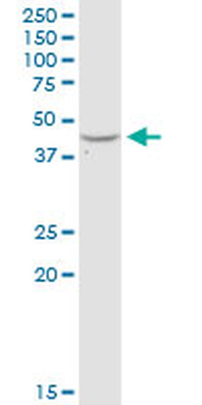 ADA Antibody in Western Blot (WB)