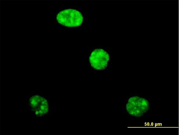 ADAR Antibody in Immunocytochemistry (ICC/IF)