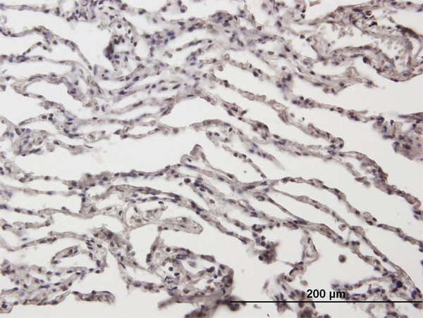 ADAR Antibody in Immunohistochemistry (Paraffin) (IHC (P))