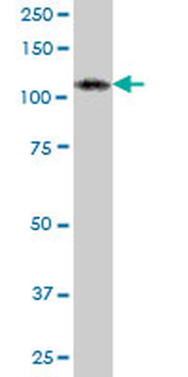 ADAR Antibody in Western Blot (WB)