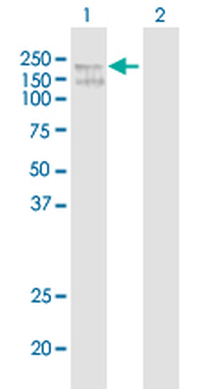 ADAR Antibody in Western Blot (WB)