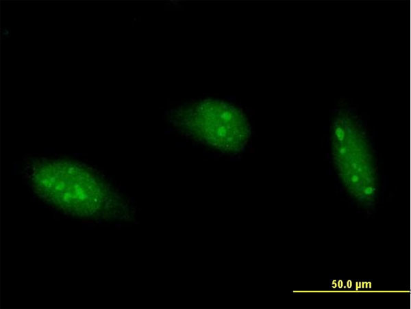 ADARB1 Antibody in Immunocytochemistry (ICC/IF)