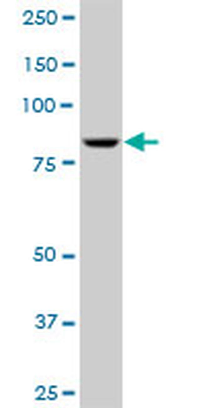 ADARB1 Antibody in Western Blot (WB)