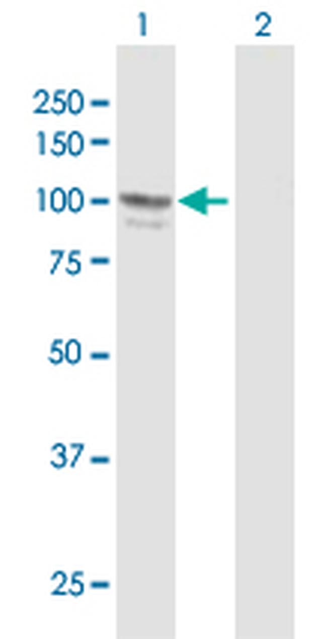 ADARB1 Antibody in Western Blot (WB)