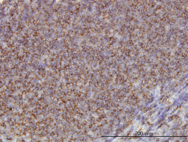 ADD1 Antibody in Immunohistochemistry (Paraffin) (IHC (P))