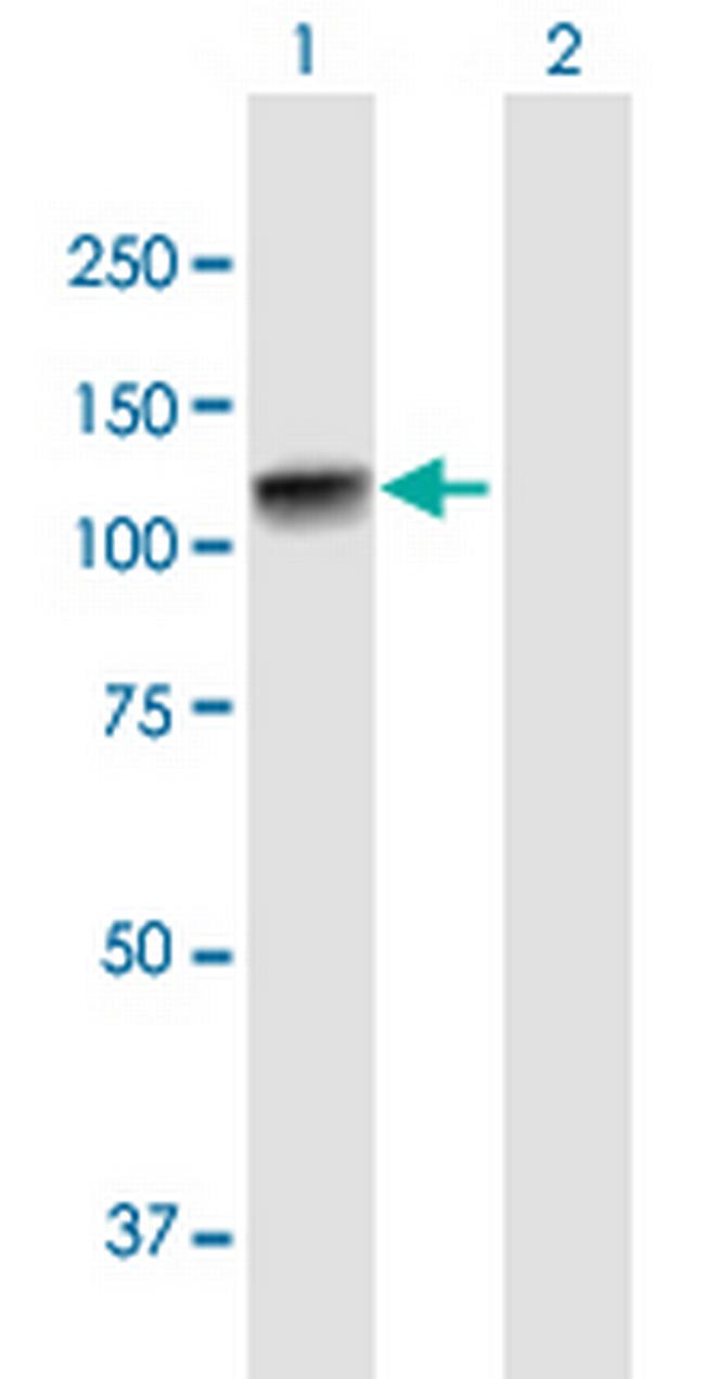 ADD2 Antibody in Western Blot (WB)