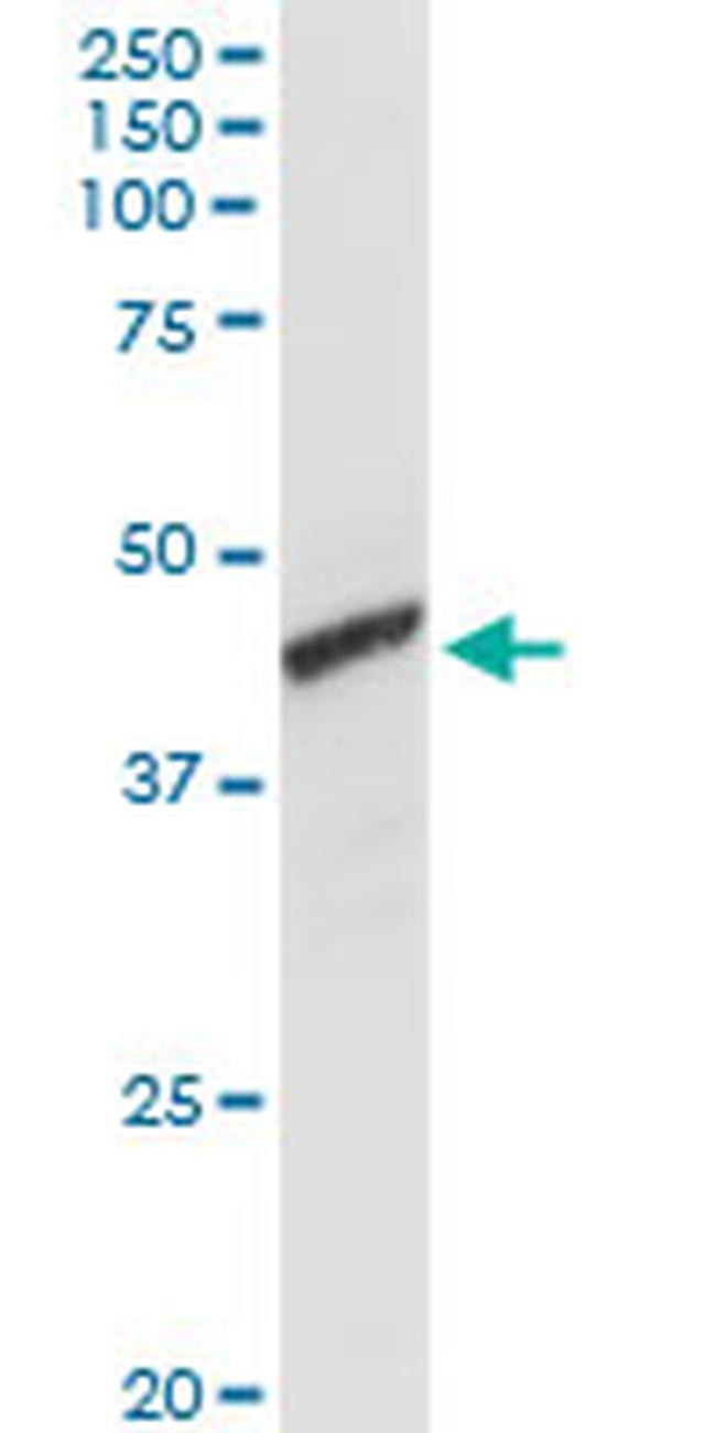 ADH1C Antibody in Western Blot (WB)