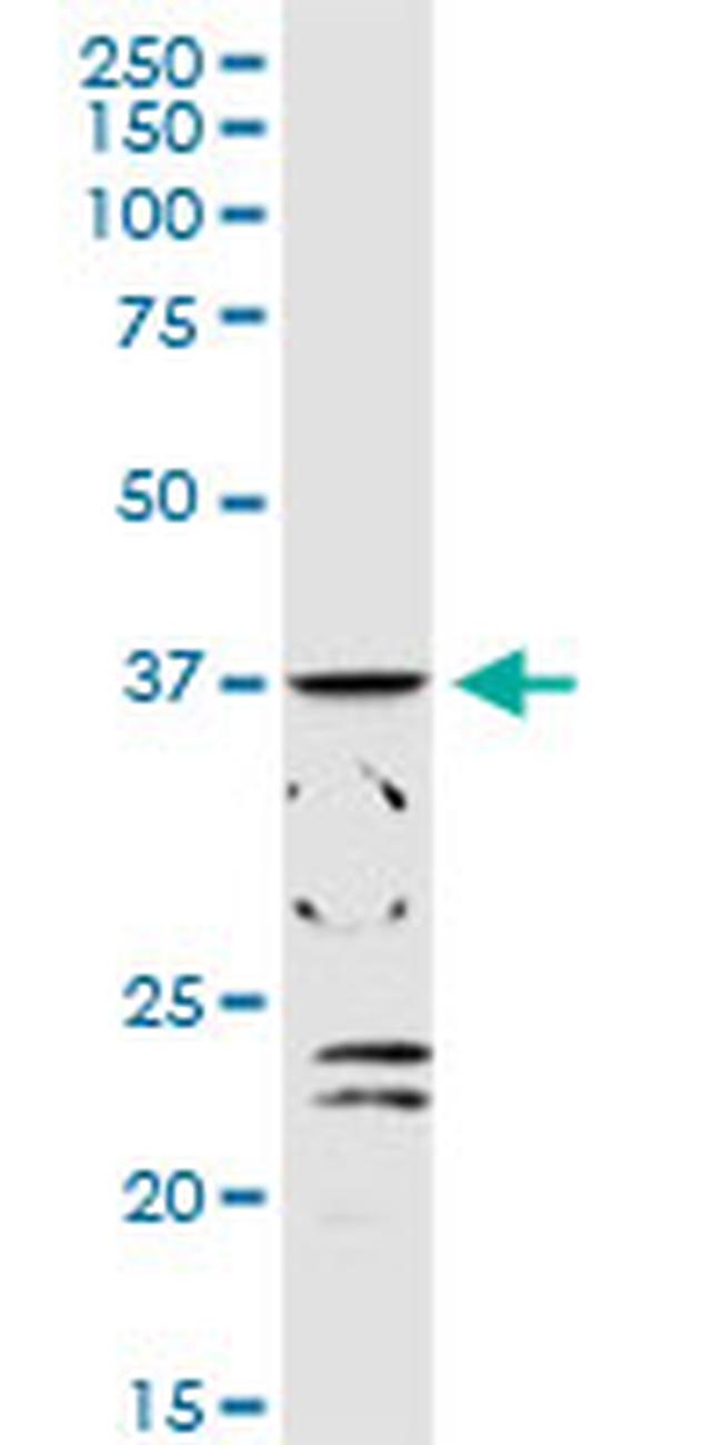 ADH1C Antibody in Western Blot (WB)