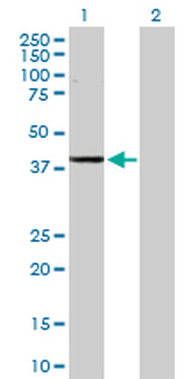 ADH1C Antibody in Western Blot (WB)