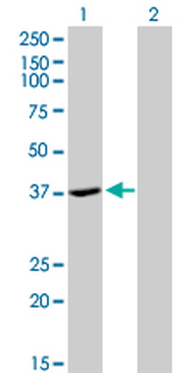 ADH4 Antibody in Western Blot (WB)