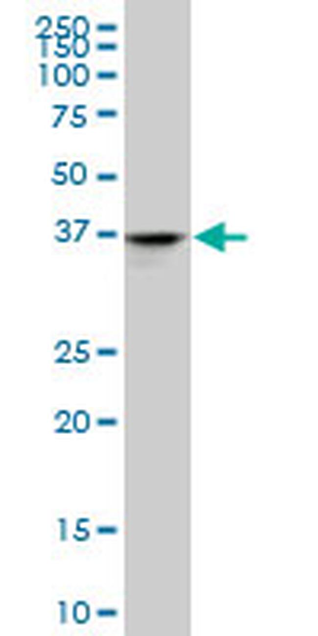 ADH4 Antibody in Western Blot (WB)