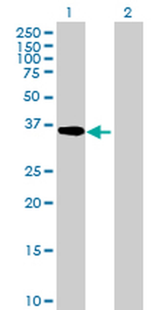 ADH5 Antibody in Western Blot (WB)