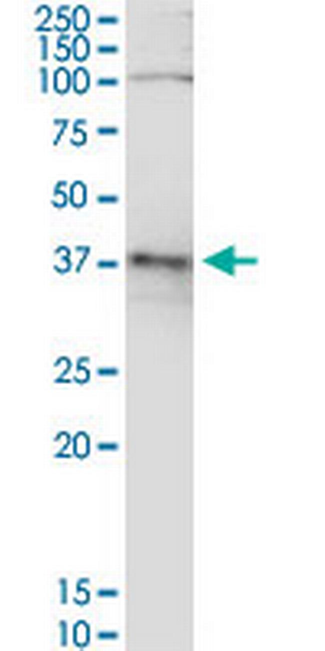 ADH5 Antibody in Western Blot (WB)