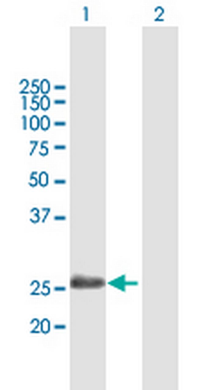 ADH6 Antibody in Western Blot (WB)