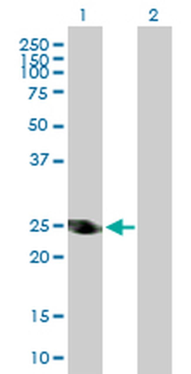 ADH6 Antibody in Western Blot (WB)