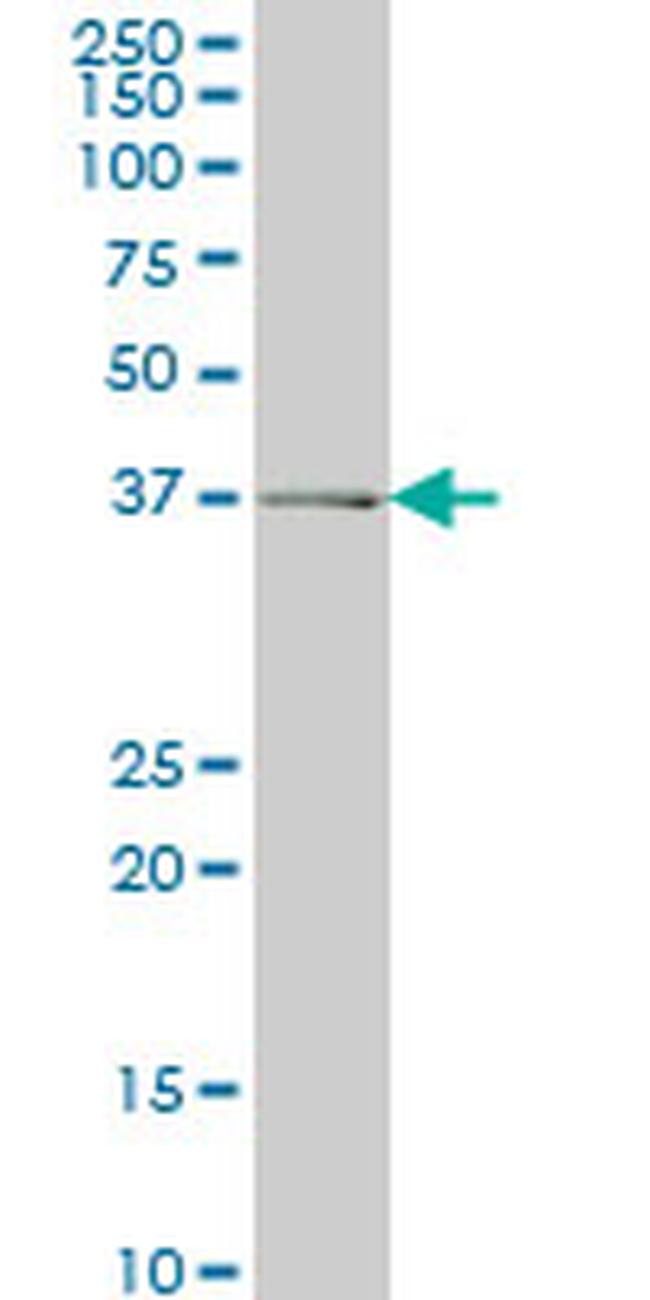 ADH6 Antibody in Western Blot (WB)