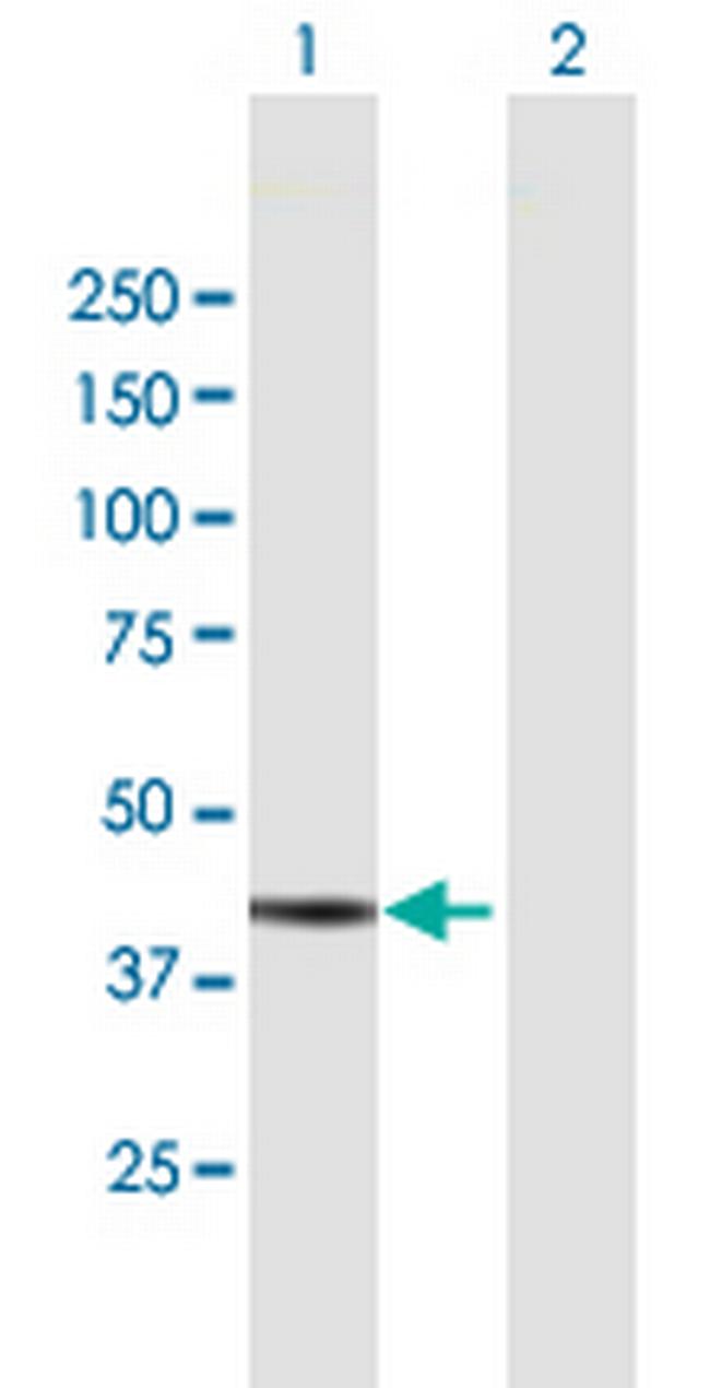 ADH7 Antibody in Western Blot (WB)