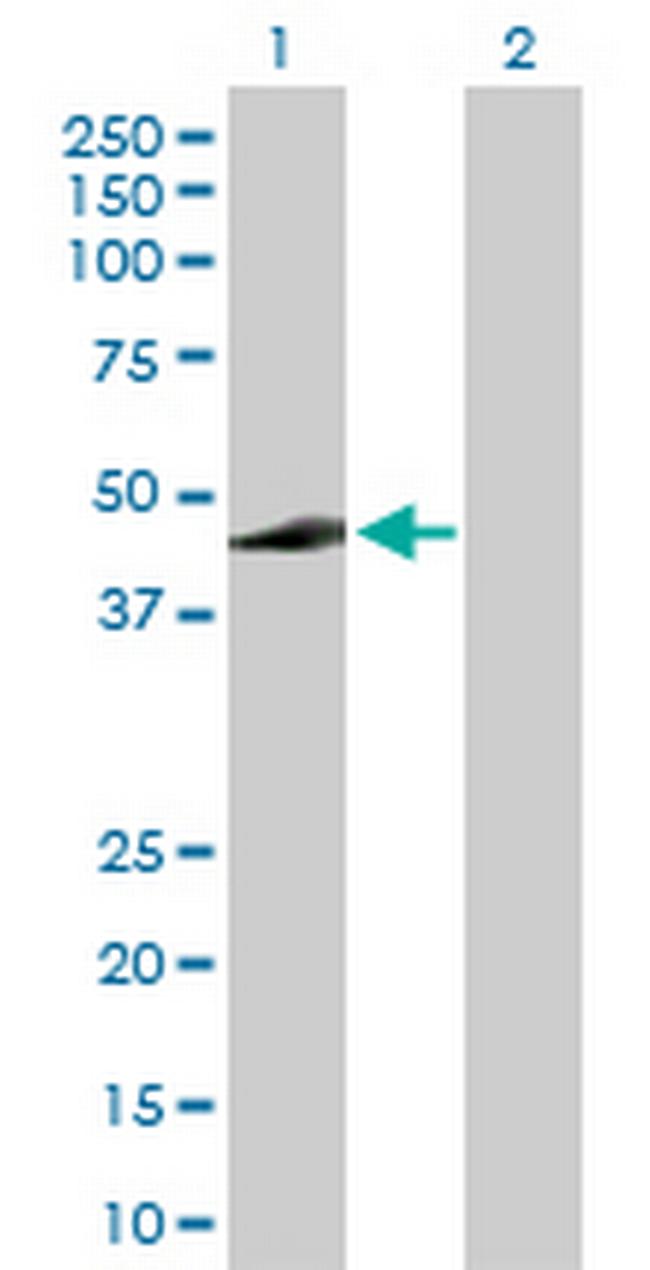 ADH7 Antibody in Western Blot (WB)