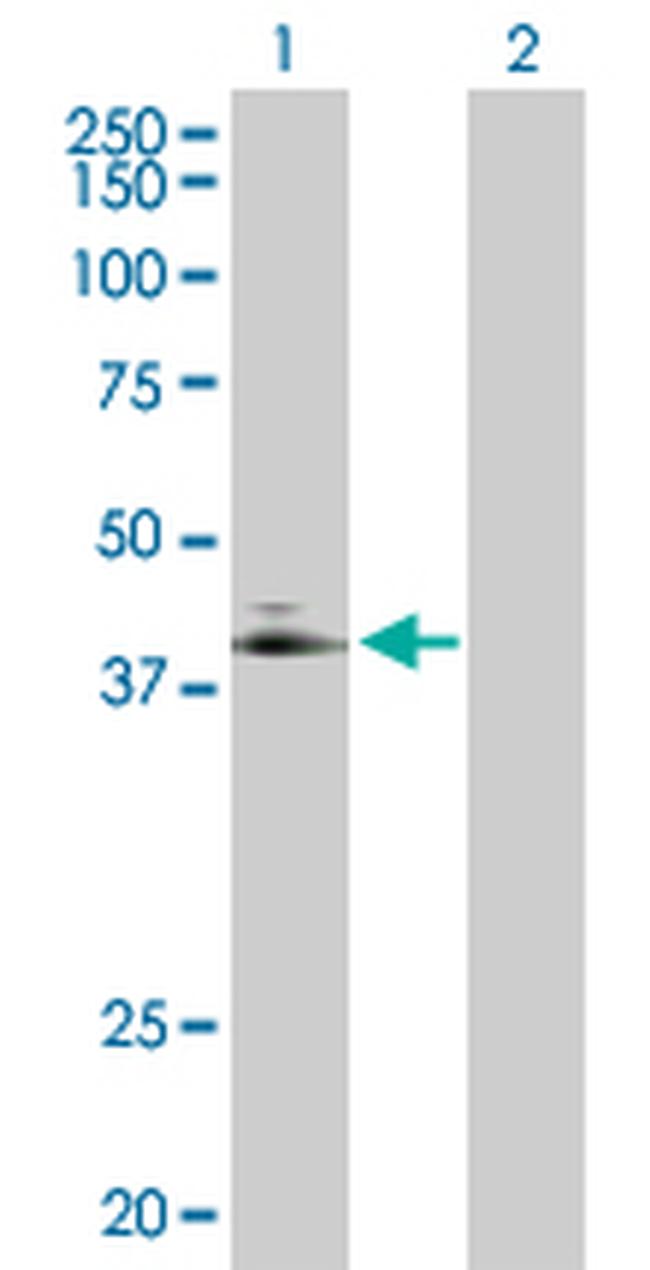 ADORA2A Antibody in Western Blot (WB)