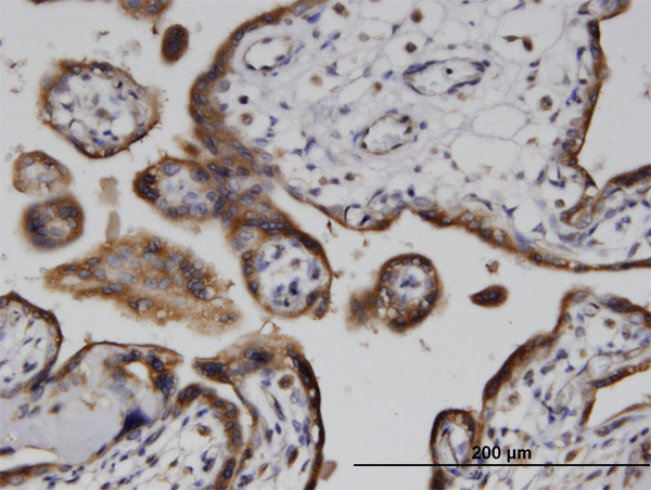 ADPRH Antibody in Immunohistochemistry (Paraffin) (IHC (P))