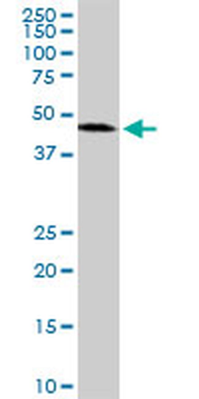 ADPRH Antibody in Western Blot (WB)