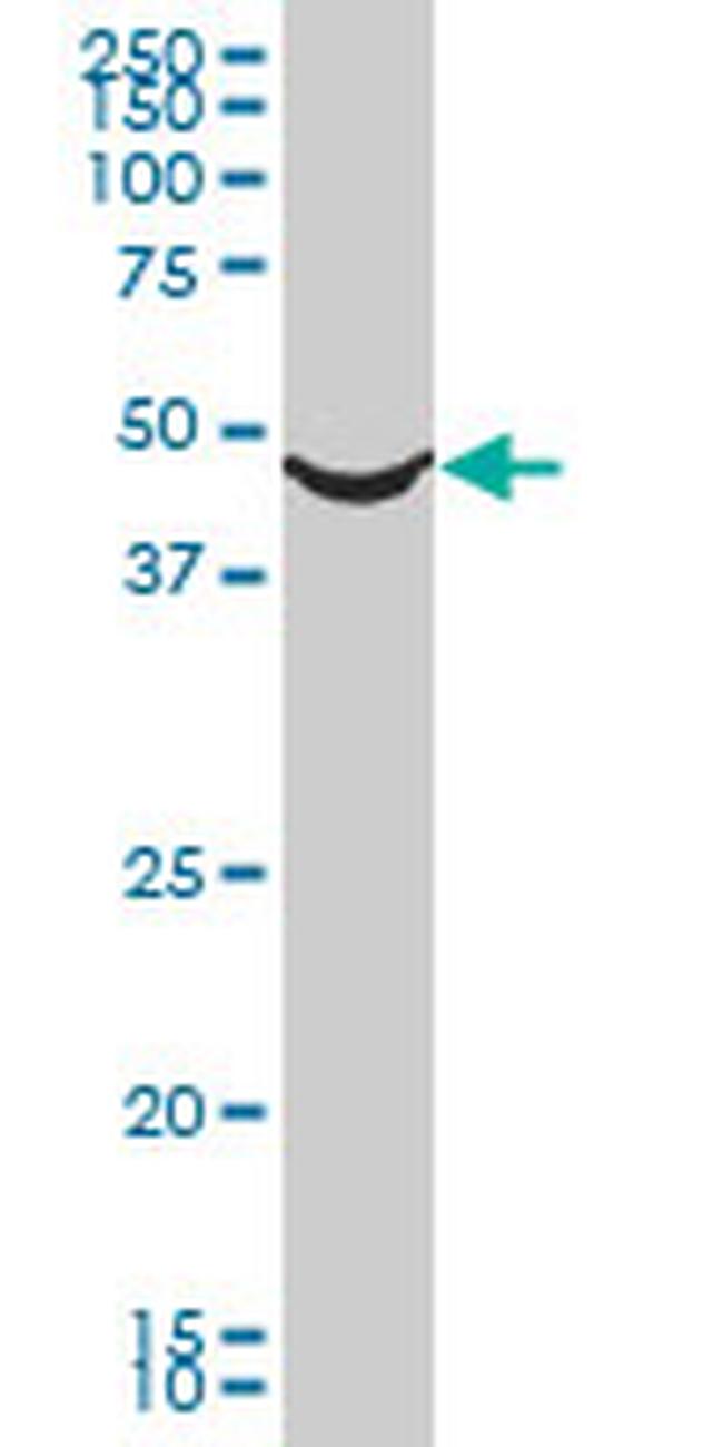 ADRA1A Antibody in Western Blot (WB)