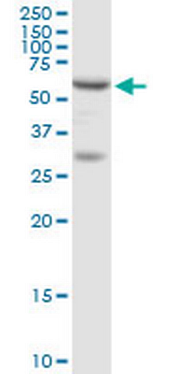 ADSL Antibody in Western Blot (WB)