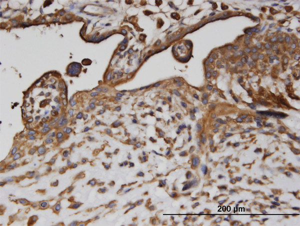 AP2B1 Antibody in Immunohistochemistry (Paraffin) (IHC (P))