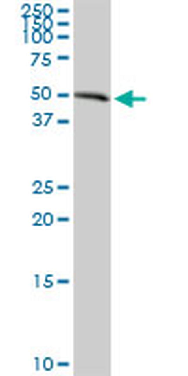 AGER Antibody in Western Blot (WB)