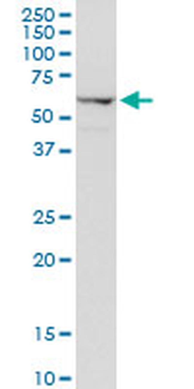 AGER Antibody in Western Blot (WB)