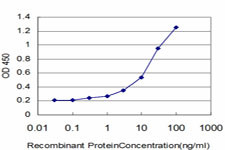 AGER Antibody in ELISA (ELISA)