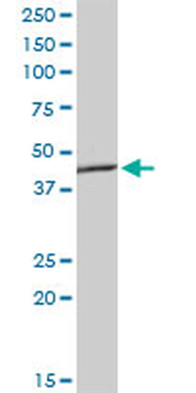 AGER Antibody in Western Blot (WB)