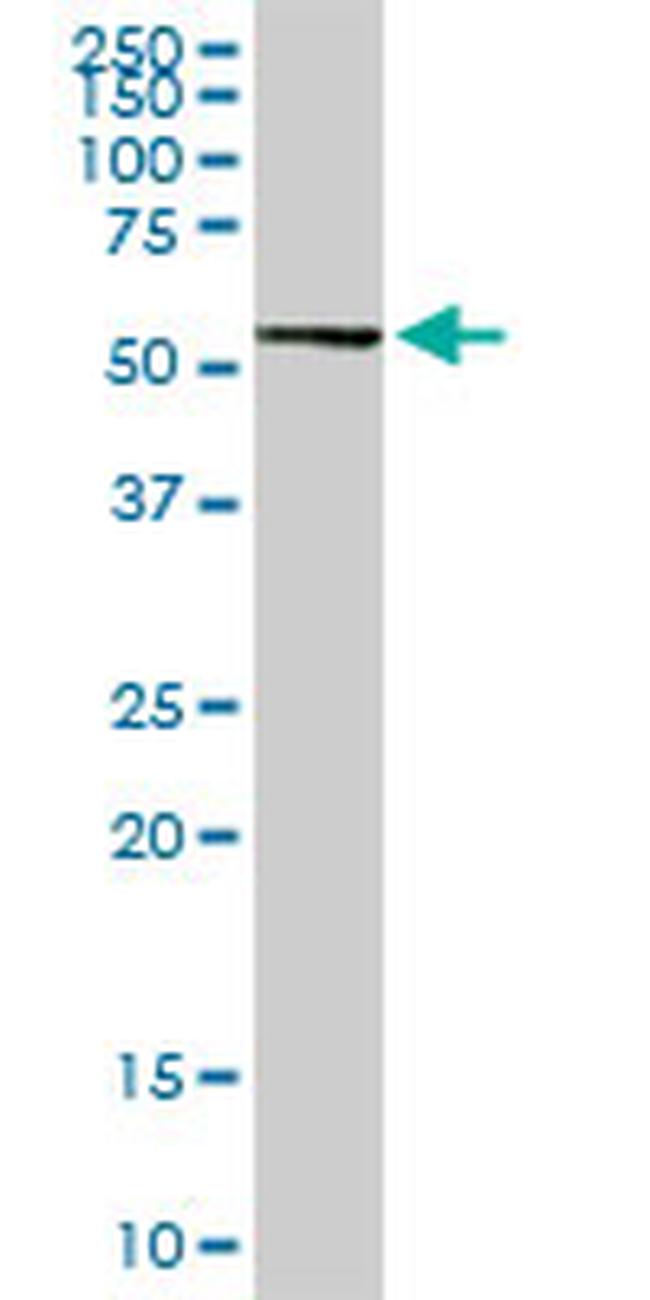 AGT Antibody in Western Blot (WB)