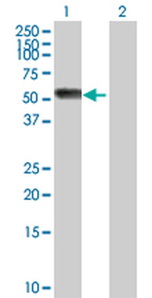 AGT Antibody in Western Blot (WB)