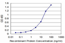 AGT Antibody in ELISA (ELISA)