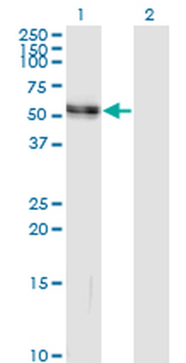 AGT Antibody in Western Blot (WB)