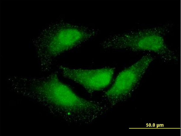 NR0B1 Antibody in Immunocytochemistry (ICC/IF)