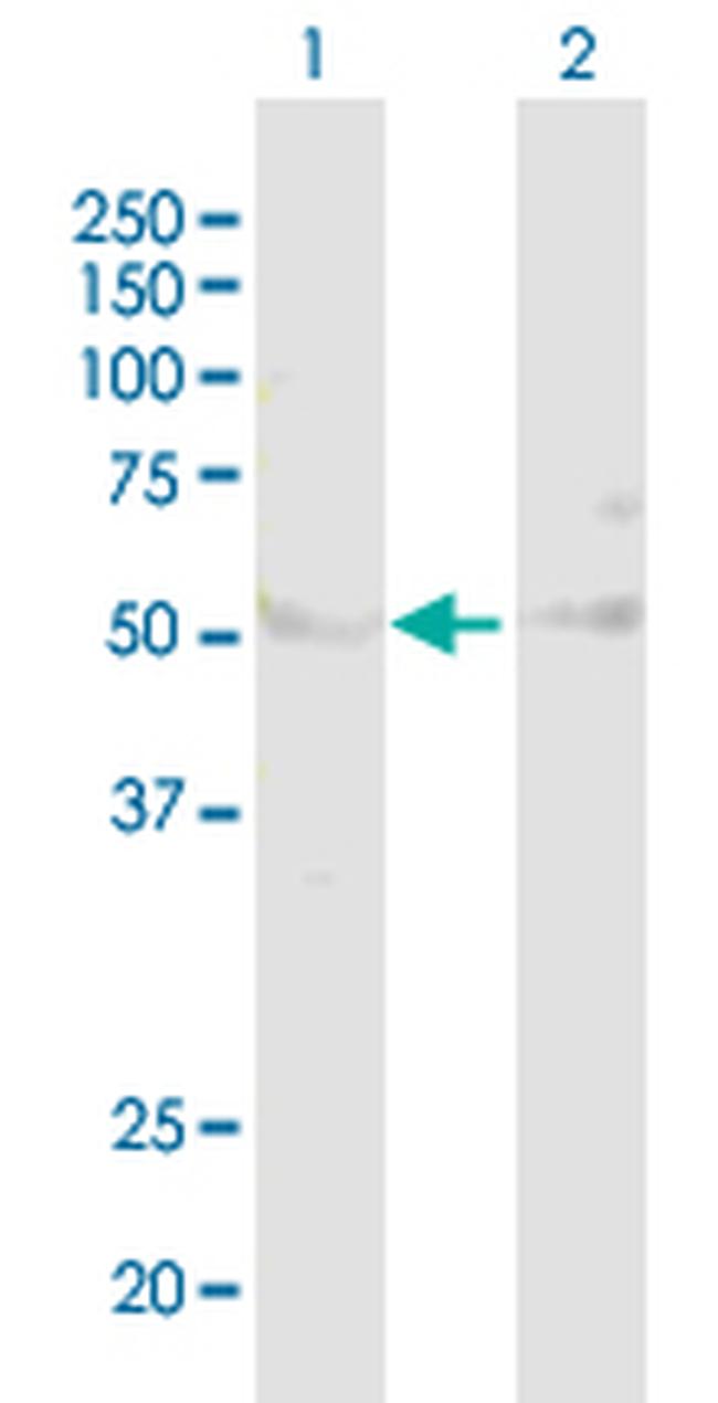 AHCY Antibody in Western Blot (WB)