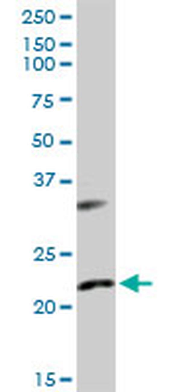 AK1 Antibody in Western Blot (WB)