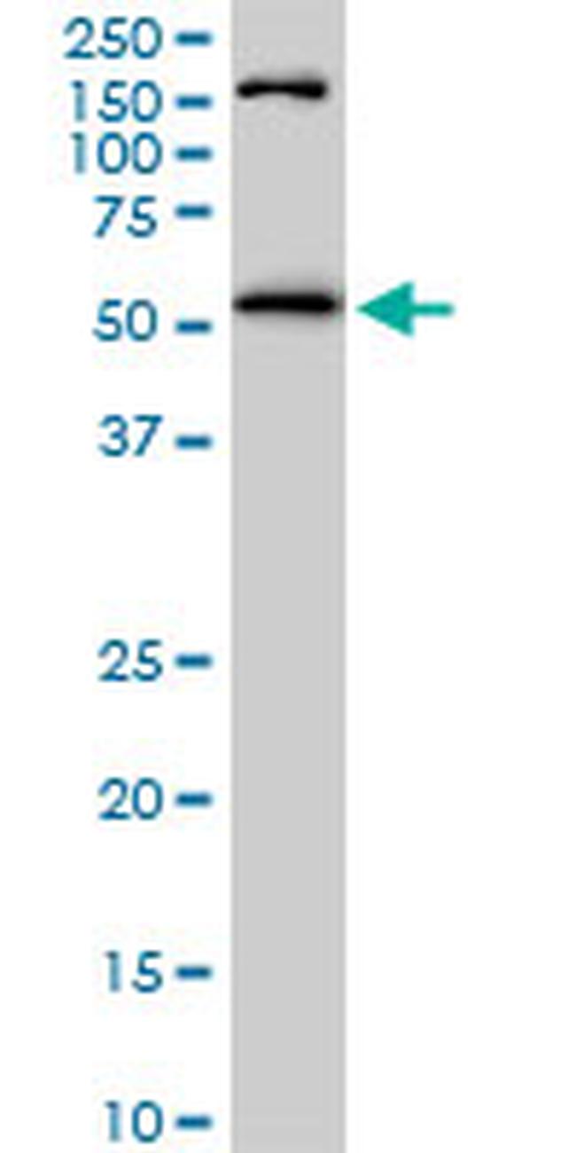 AKT1 Antibody in Western Blot (WB)