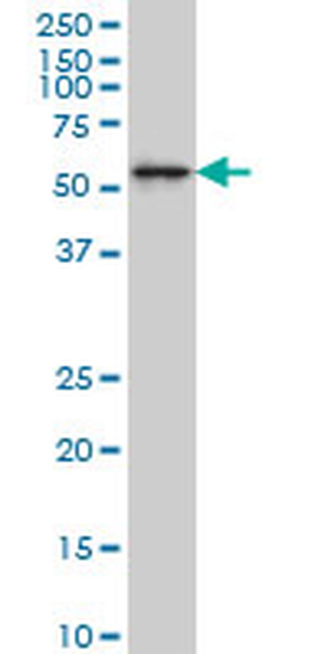 AKT1 Antibody in Western Blot (WB)