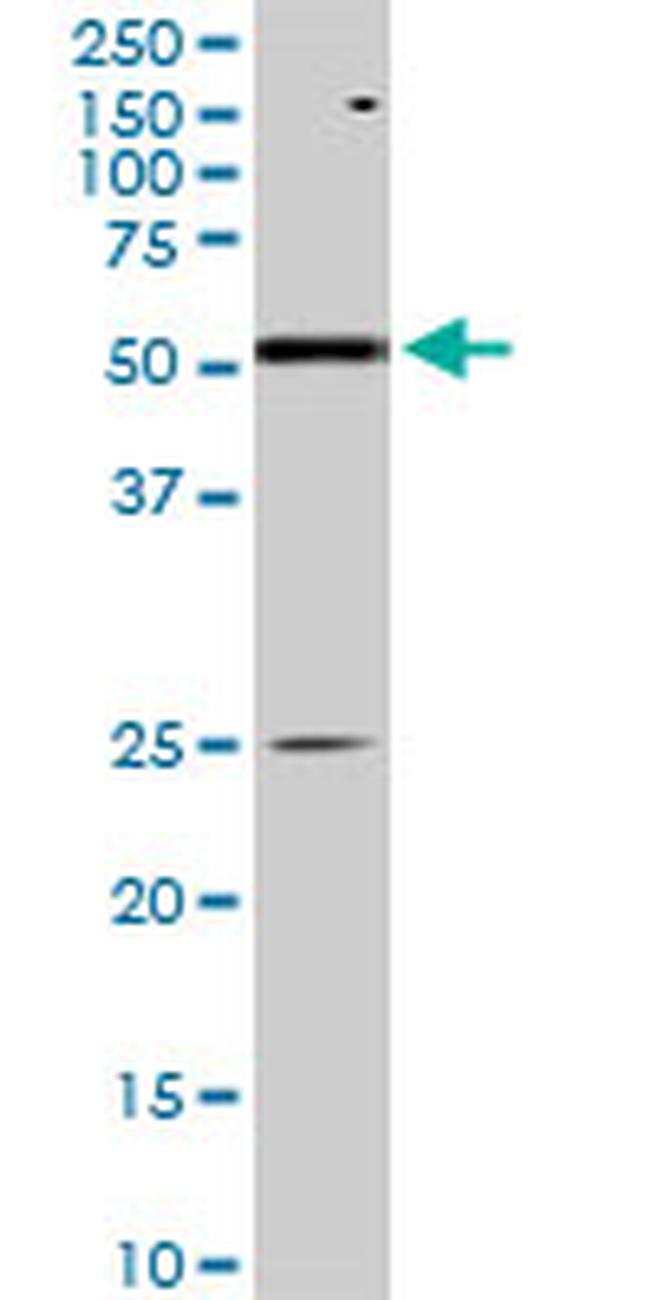 AKT1 Antibody in Western Blot (WB)