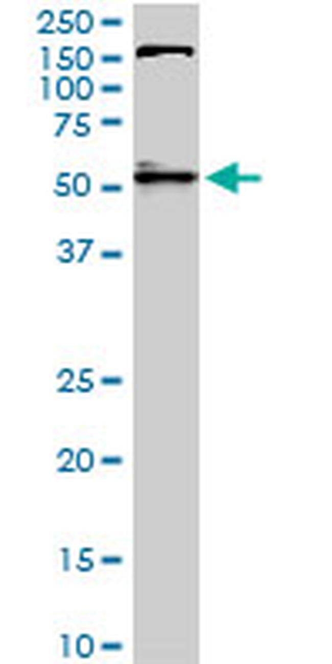 AKT1 Antibody in Western Blot (WB)