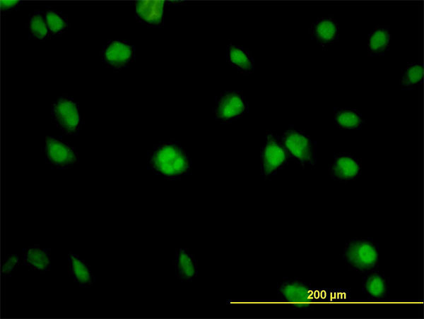 AKT1 Antibody in Immunocytochemistry (ICC/IF)