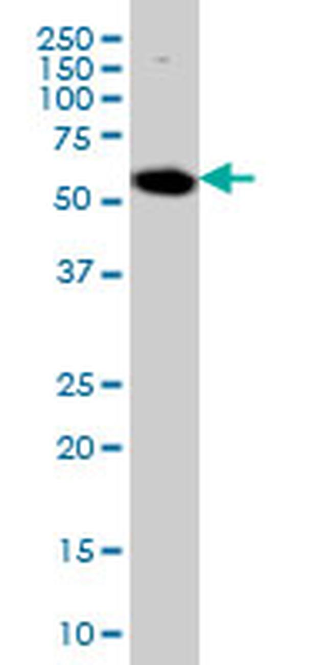 AKT1 Antibody in Western Blot (WB)