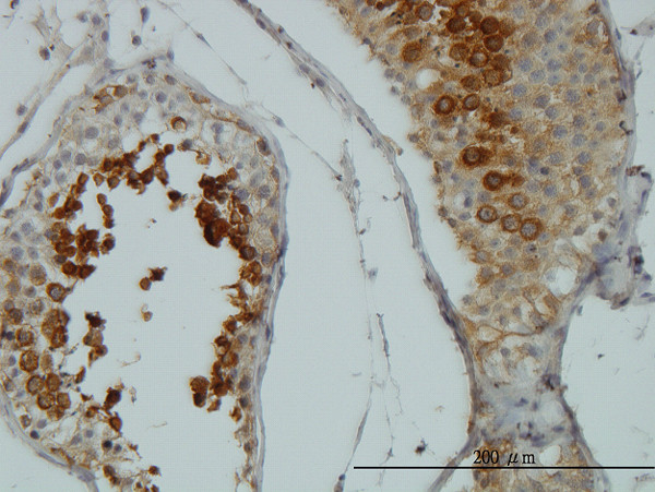 AKT1 Antibody in Immunohistochemistry (Paraffin) (IHC (P))